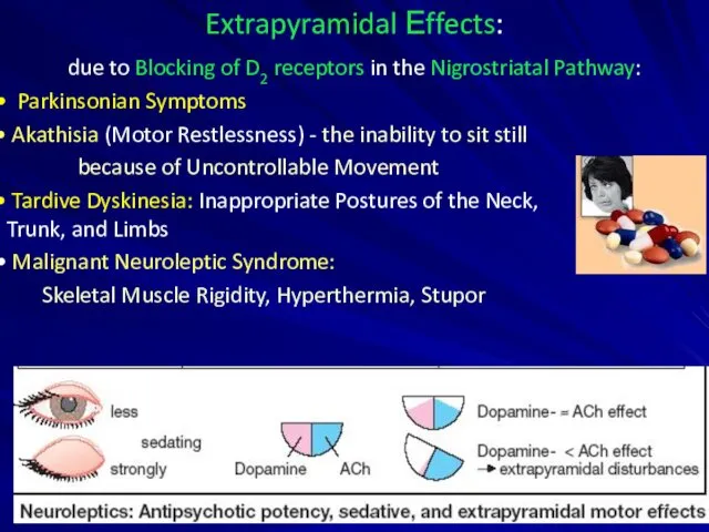 Extrapyramidal Еffects: due to Blocking of D2 receptors in the Nigrostriatal Pathway: Parkinsonian