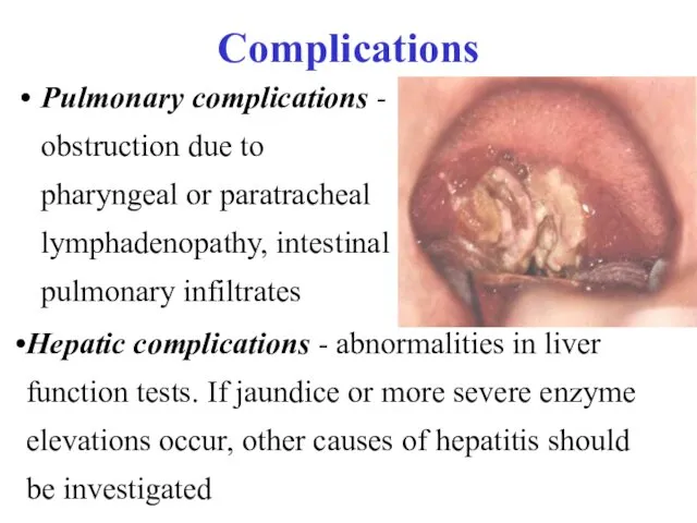 Complications Pulmonary complications - obstruction due to pharyngeal or paratracheal