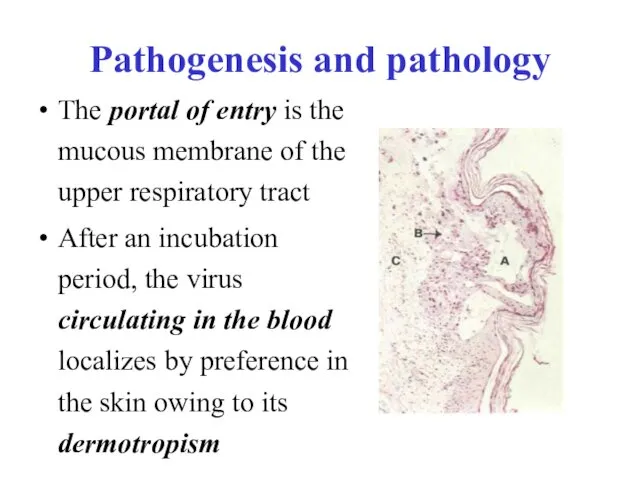 Pathogenesis and pathology The portal of entry is the mucous