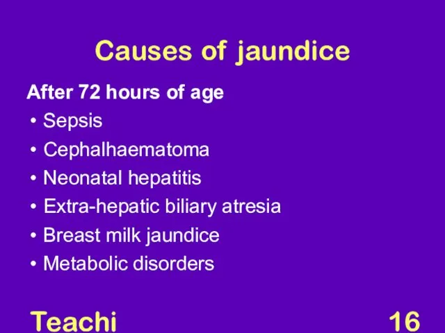 Teaching Aids: NNF Causes of jaundice After 72 hours of age Sepsis Cephalhaematoma