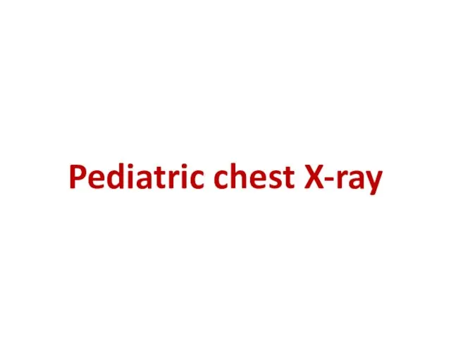 Pediatric chest X-ray