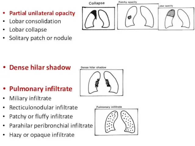 Partial unilateral opacity Lobar consolidation Lobar collapse Solitary patch or