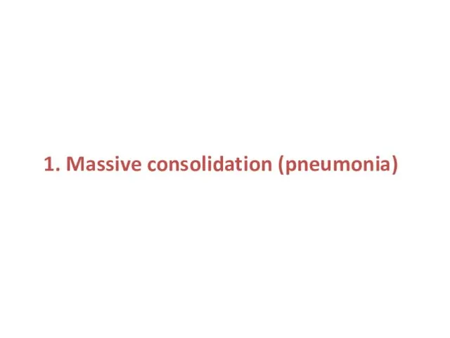 1. Massive consolidation (pneumonia)
