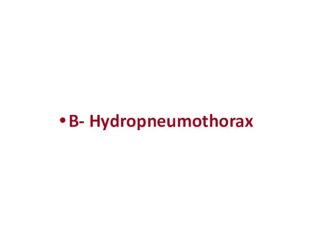 B- Hydropneumothorax