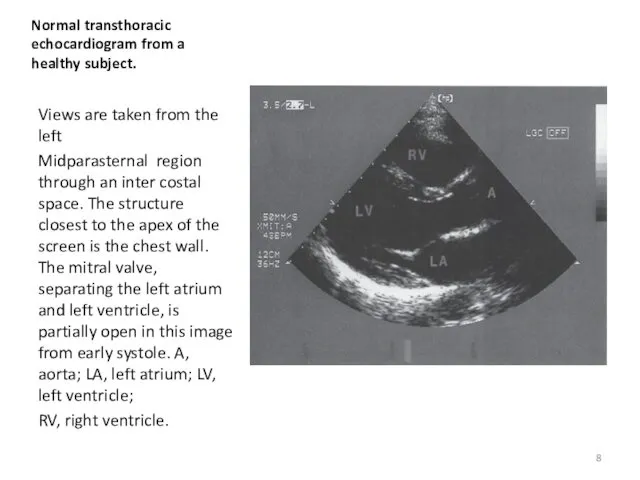 Normal transthoracic echocardiogram from a healthy subject. Views are taken from the left