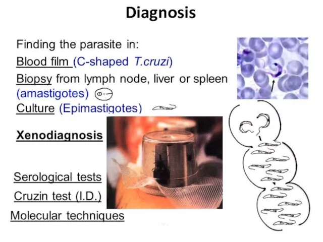 Diagnosis