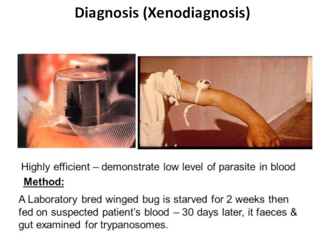Diagnosis (Xenodiagnosis)