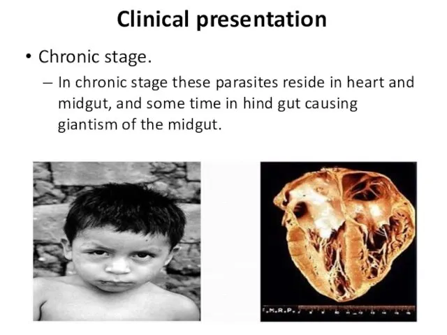 Chronic stage. In chronic stage these parasites reside in heart and midgut, and