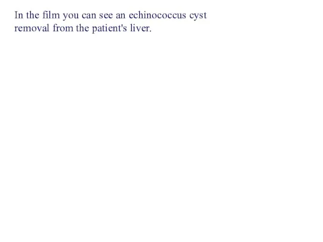 In the film you can see an echinococcus cyst removal from the patient's liver.