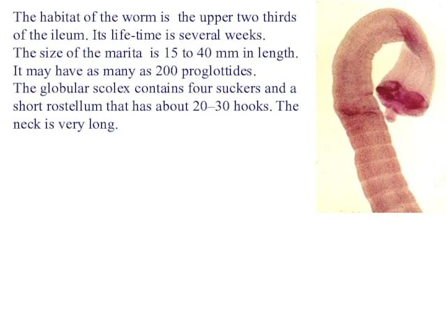 The habitat of the worm is the upper two thirds