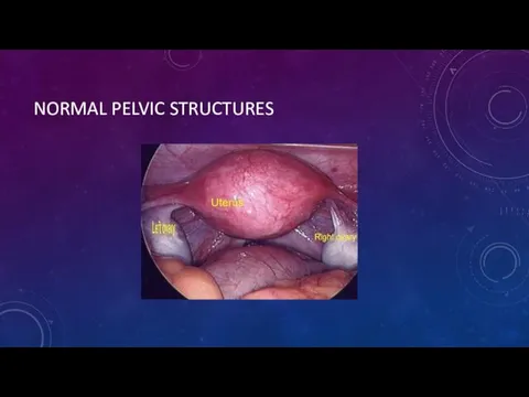 NORMAL PELVIC STRUCTURES