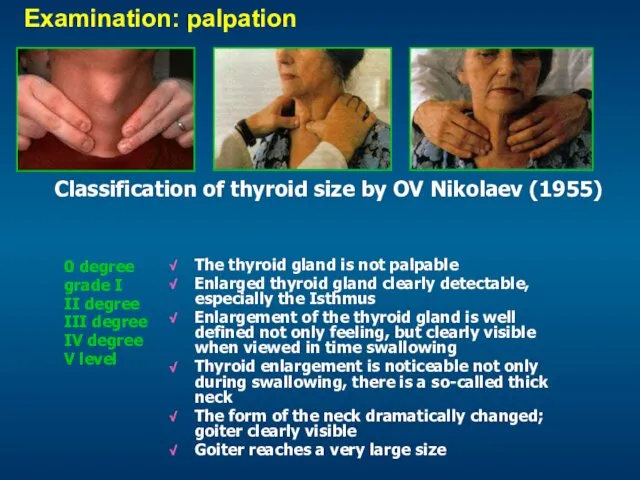 Classification of thyroid size by OV Nikolaev (1955) 0 degree