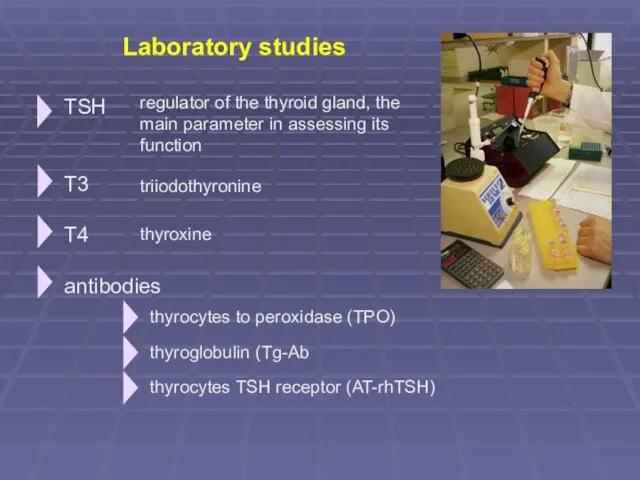 TSH T3 T4 antibodies Laboratory studies regulator of the thyroid