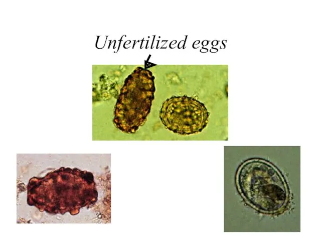 Unfertilized eggs