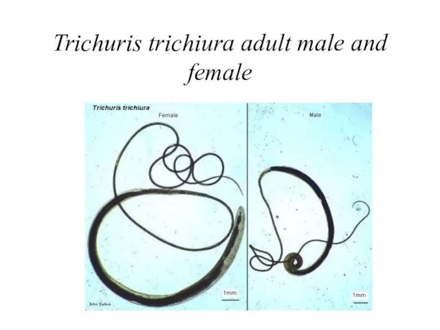 Trichuris trichiura adult male and female