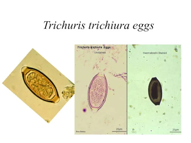 Trichuris trichiura eggs