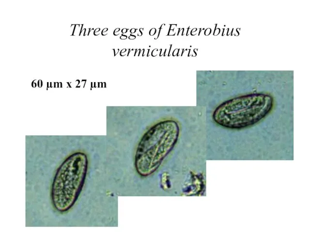 Three eggs of Enterobius vermicularis 60 µm x 27 µm