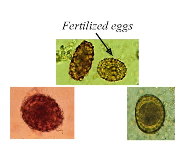 Fertilized eggs