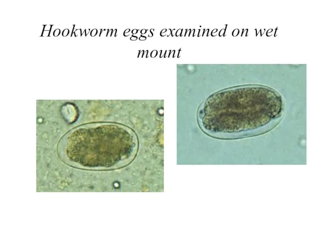Hookworm eggs examined on wet mount
