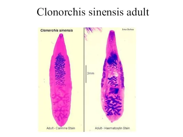 Clonorchis sinensis adult