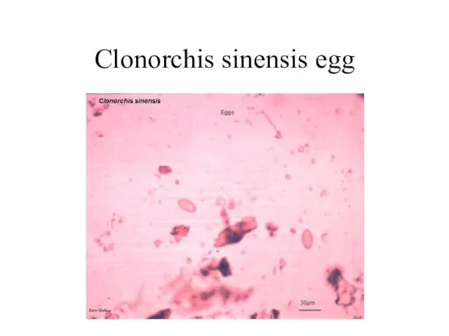 Clonorchis sinensis egg