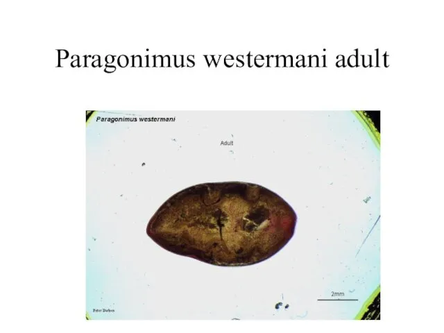 Paragonimus westermani adult