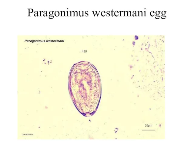 Paragonimus westermani egg