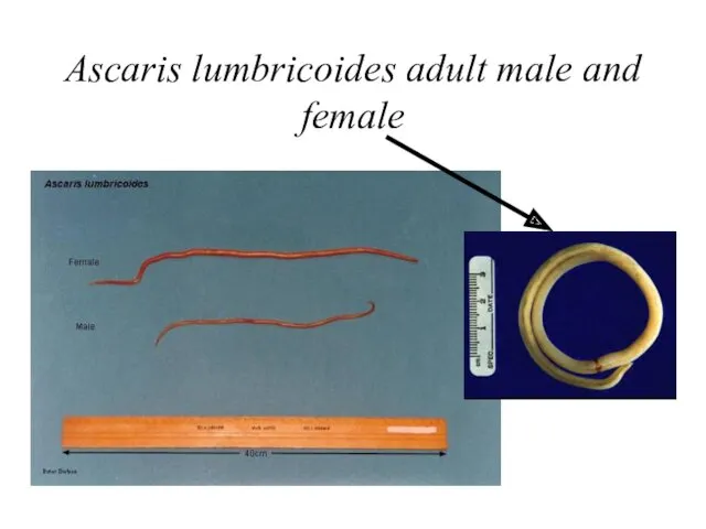 Ascaris lumbricoides adult male and female