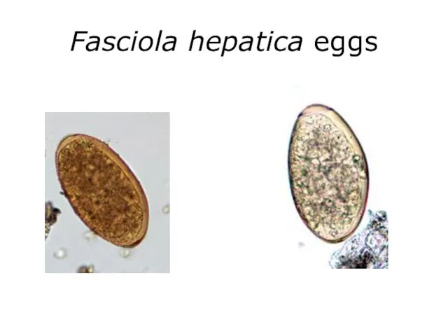 Fasciola hepatica eggs