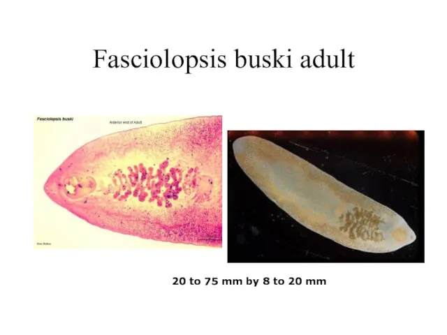 Fasciolopsis buski adult 20 to 75 mm by 8 to 20 mm