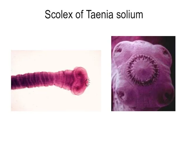 Scolex of Taenia solium