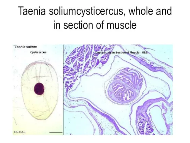 Taenia soliumcysticercus, whole and in section of muscle