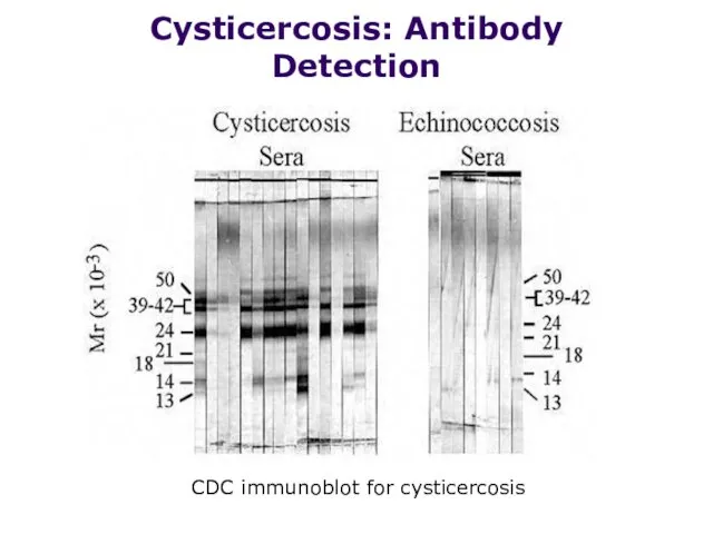 Cysticercosis: Antibody Detection CDC immunoblot for cysticercosis