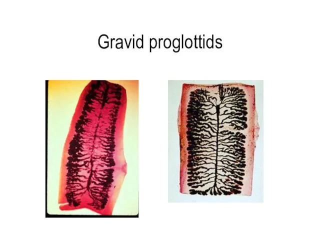 Gravid proglottids