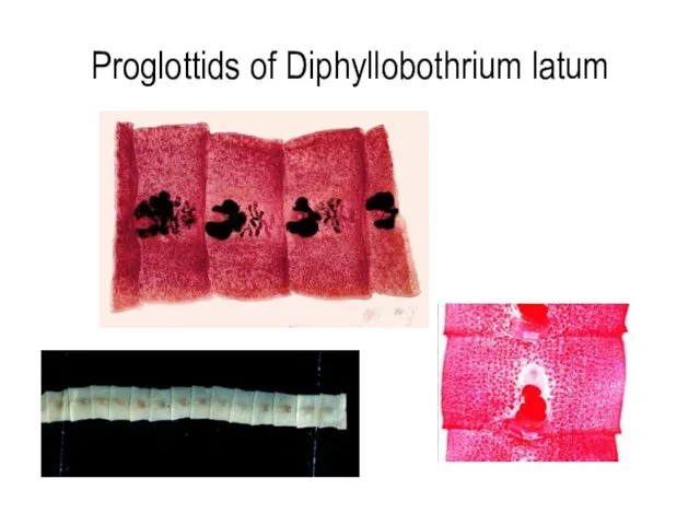 Proglottids of Diphyllobothrium latum