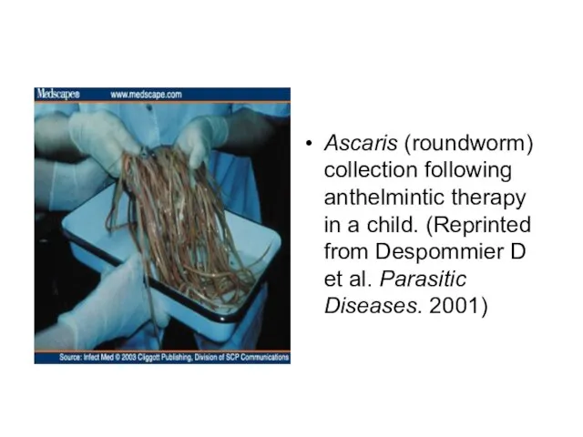 Ascaris (roundworm) collection following anthelmintic therapy in a child. (Reprinted from Despommier D