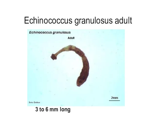 Echinococcus granulosus adult