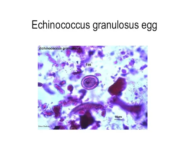 Echinococcus granulosus egg