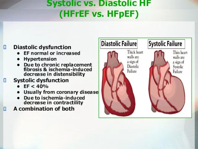 Systolic vs. Diastolic HF (HFrEF vs. HFpEF) Diastolic dysfunction EF normal or increased
