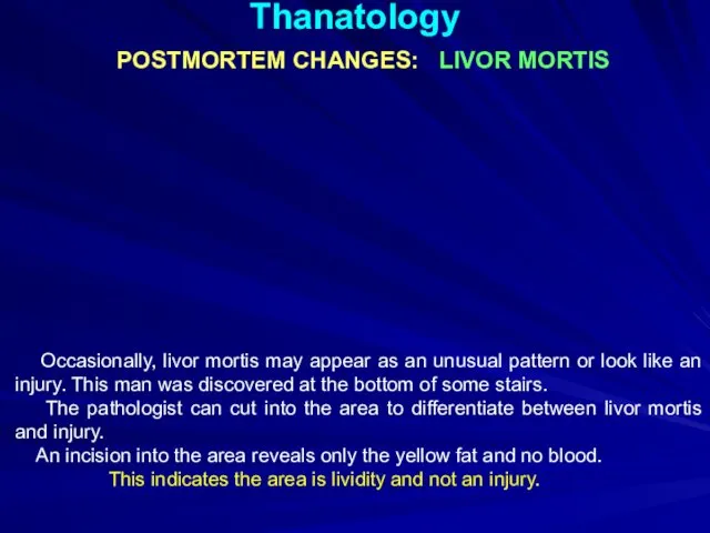 Thanatology POSTMORTEM CHANGES: LIVOR MORTIS Occasionally, livor mortis may appear