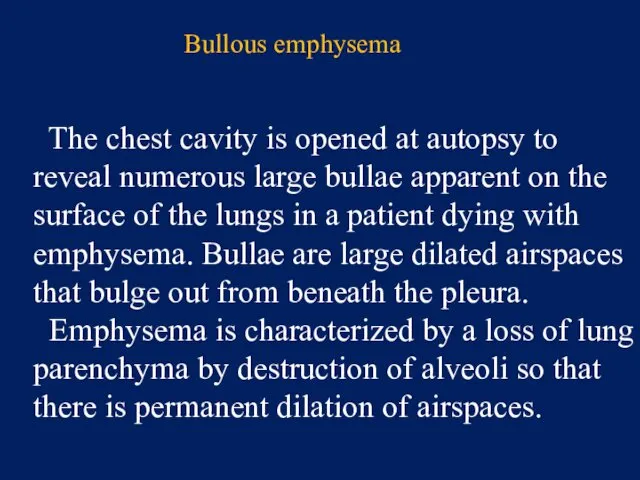 Bullous emphysema The chest cavity is opened at autopsy to