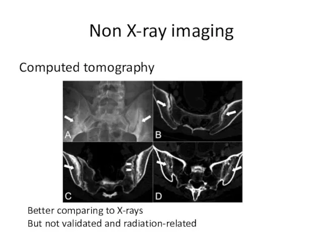 Non X-ray imaging Computed tomography Better comparing to X-rays But not validated and radiation-related