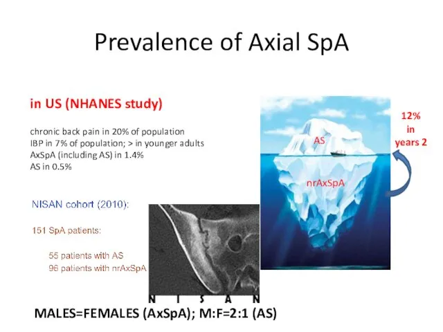 Prevalence of Axial SpA in US (NHANES study) chronic back