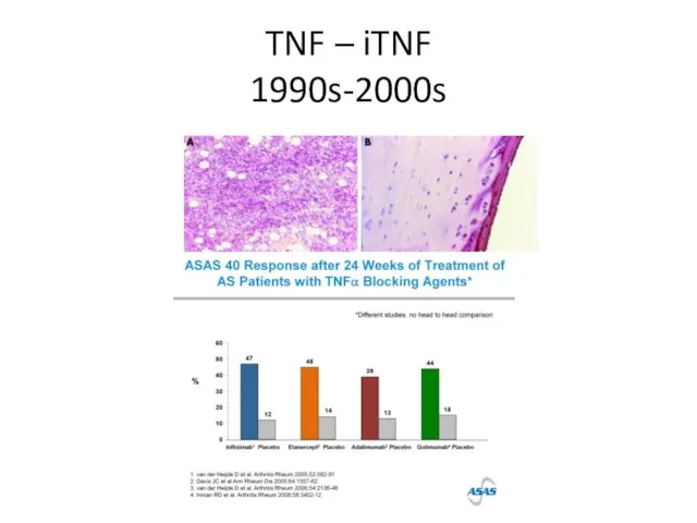 TNF – iTNF 1990s-2000s