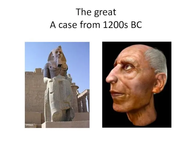 The great A case from 1200s BC