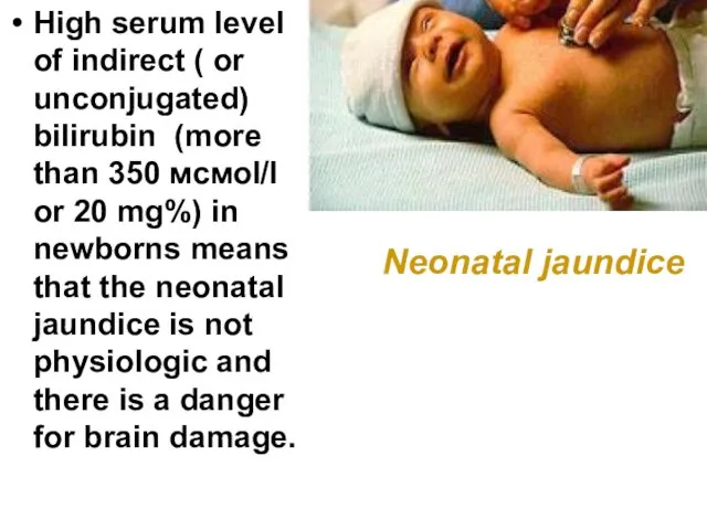 High serum level of indirect ( or unconjugated) bilirubin (more