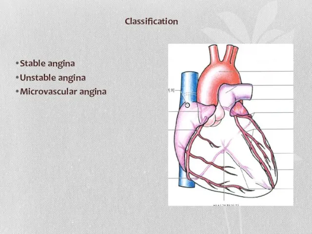 Classification Stable angina Unstable angina Microvascular angina