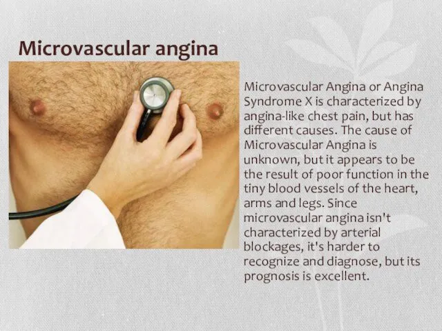 Microvascular angina Microvascular Angina or Angina Syndrome X is characterized