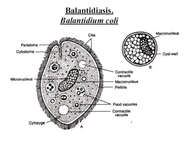 Balantidiasis. Balantidium coli