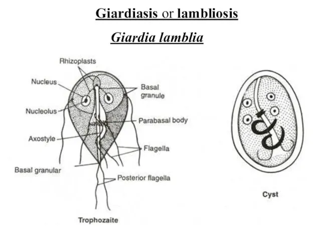 Giardiasis or lambliosis Giardia lamblia